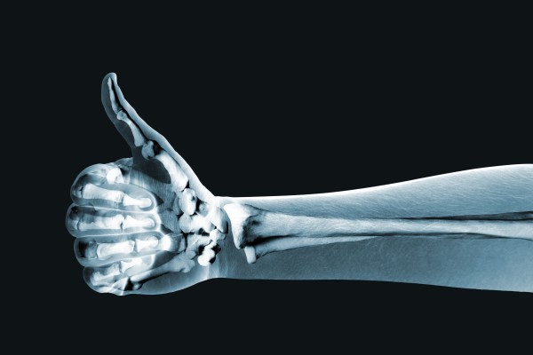 3D X-Ray