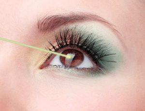 Laser Eye Correction